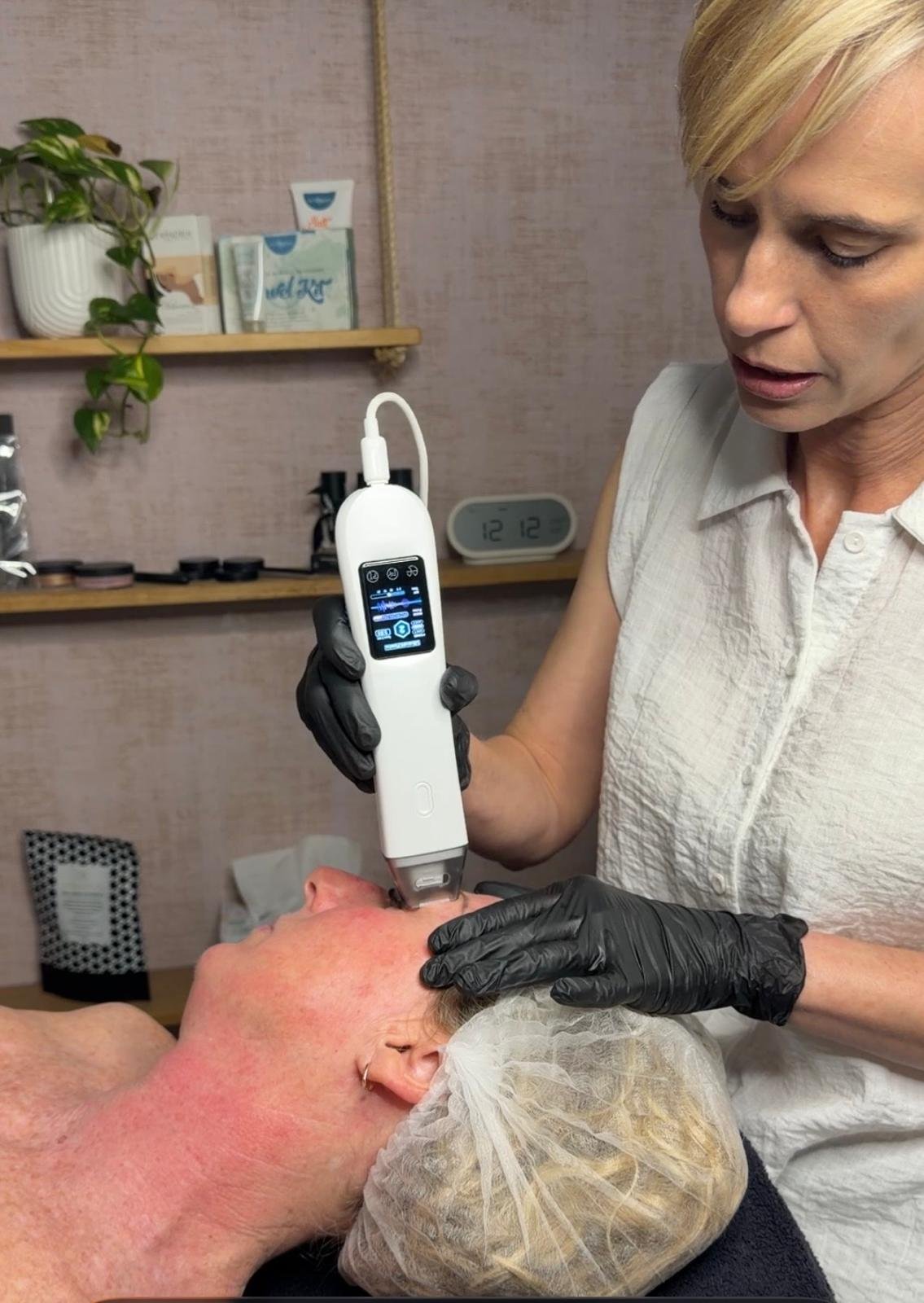 Bonnie providing a T33 facial treatment to a client in the clinic